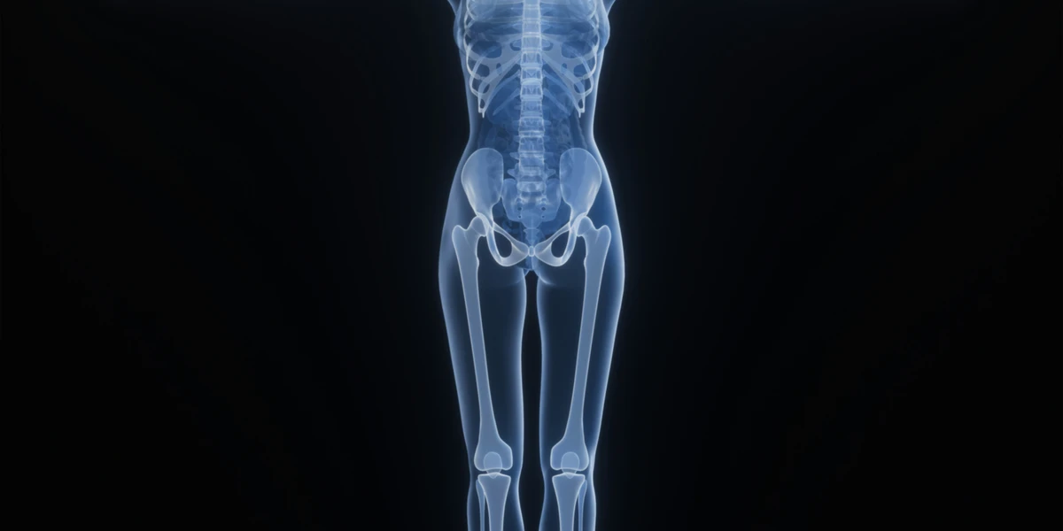 Do You Really Need to Lift Heavy Weights to Improve Bone Density?