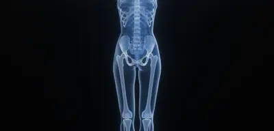 Do You Really Need to Lift Heavy Weights to Improve Bone Density?